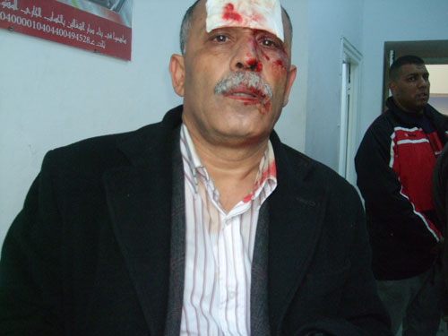 Un des blessés suite à l'attaque des extrémistes sur le siège de l'UGTT