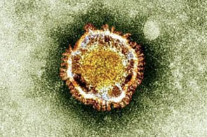 coronavirus 5 20
