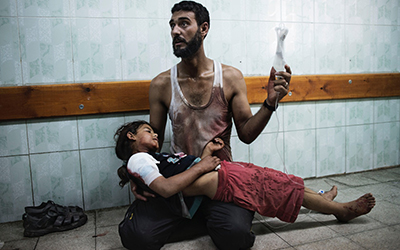 Filette-blessee-a-Gaza