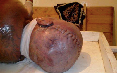 Snoussi-Traces-de-tortures-2